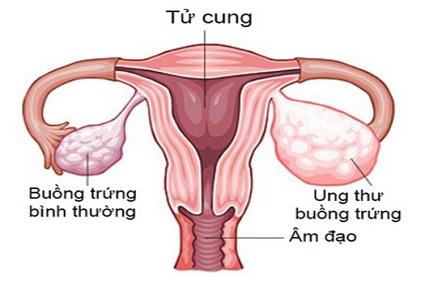 nhung-dieu-co-ban-chua-biet-ve-buong-trung-cua-phu-nu