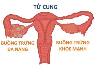 da-nang-buong-trung-1-ben-2-ben