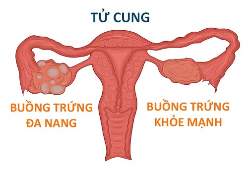 buong-trung-da-nang da-nang-buong-trung-1-ben-2-ben