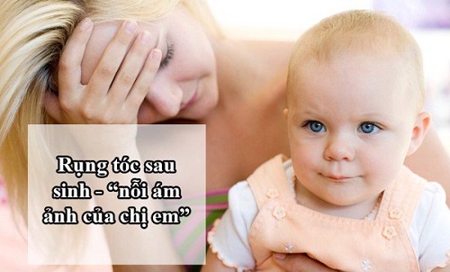rung-toc-sau-sinh rụng tóc sau sinh