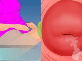Đặt thuốc phụ khoa bị ra nước